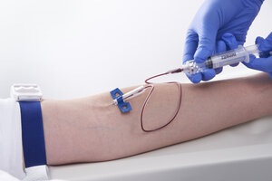 Eigenblut-/ Stammzellen-Therapie